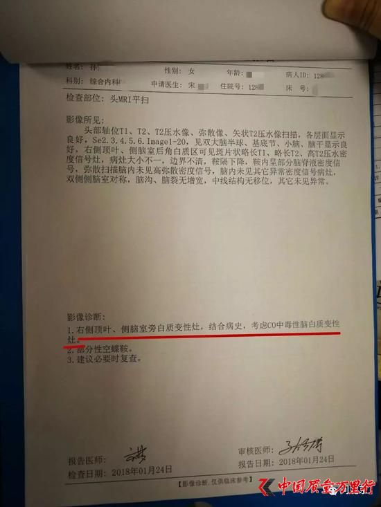 孫女士檢查結(jié)果顯示存在一氧化碳中毒性腦白質(zhì)變性/受訪者提供