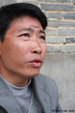 投訴者陳丕旺額頭上的傷口深得可怕,已經(jīng)破相了。