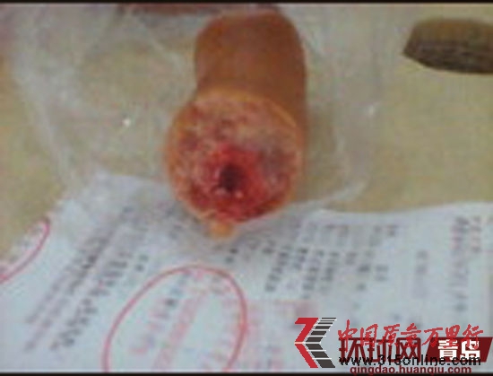 天瑞祥火腿咬出“色素塊” 天瑞祥火腿咬出“色素塊”