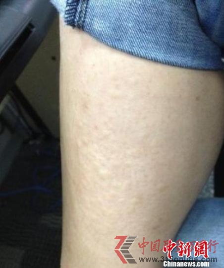 南京水魔方致游客瘙癢衛生部門稱余氯含量超標