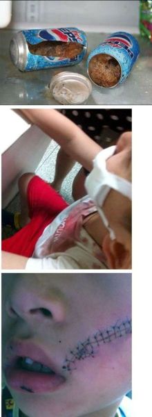 上海嘉定一男孩從冰箱冷凍室拿出一聽百事可樂,開啟瞬間突然發生爆炸。圖片來源:消費者微博