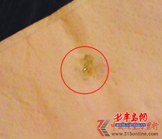 這就是惹禍的玻璃碴。